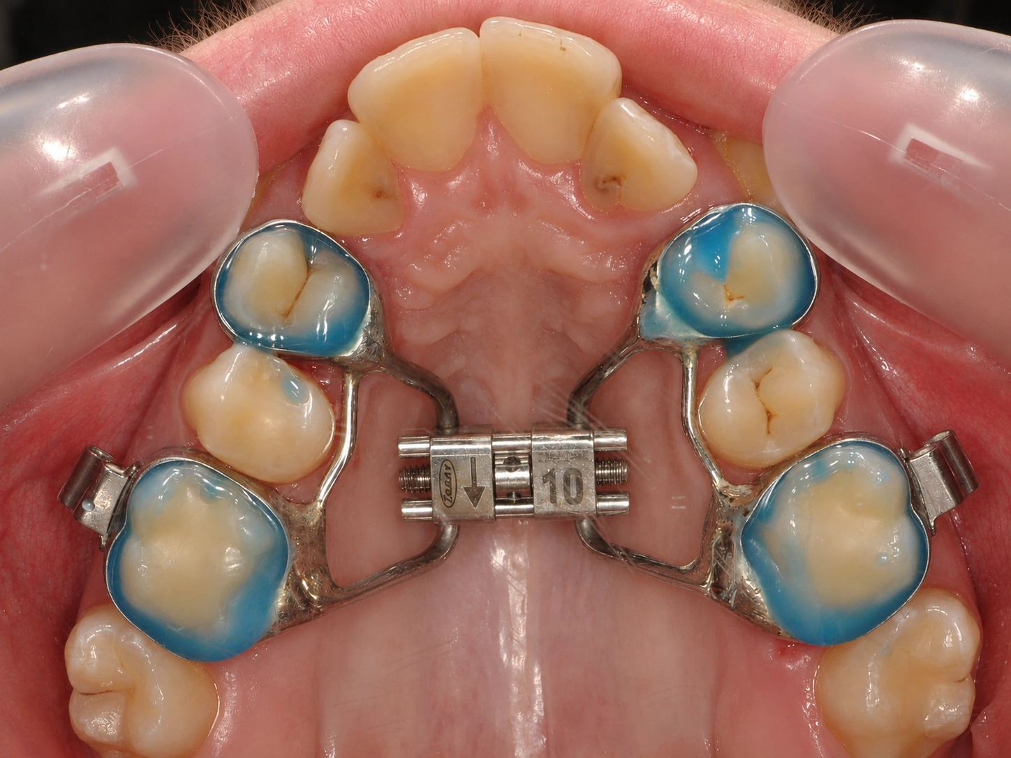 Consulta pediátrica Porto Smile