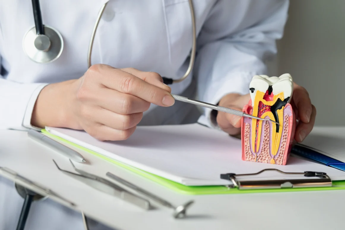 Endodontia Porto Smile resultado