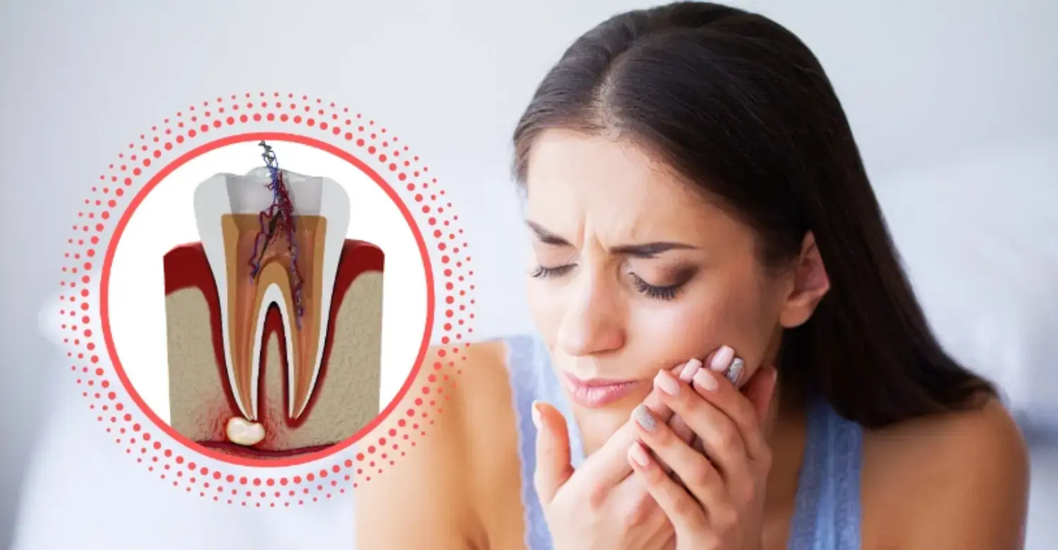 Endodontia Porto Smile Matosinhos