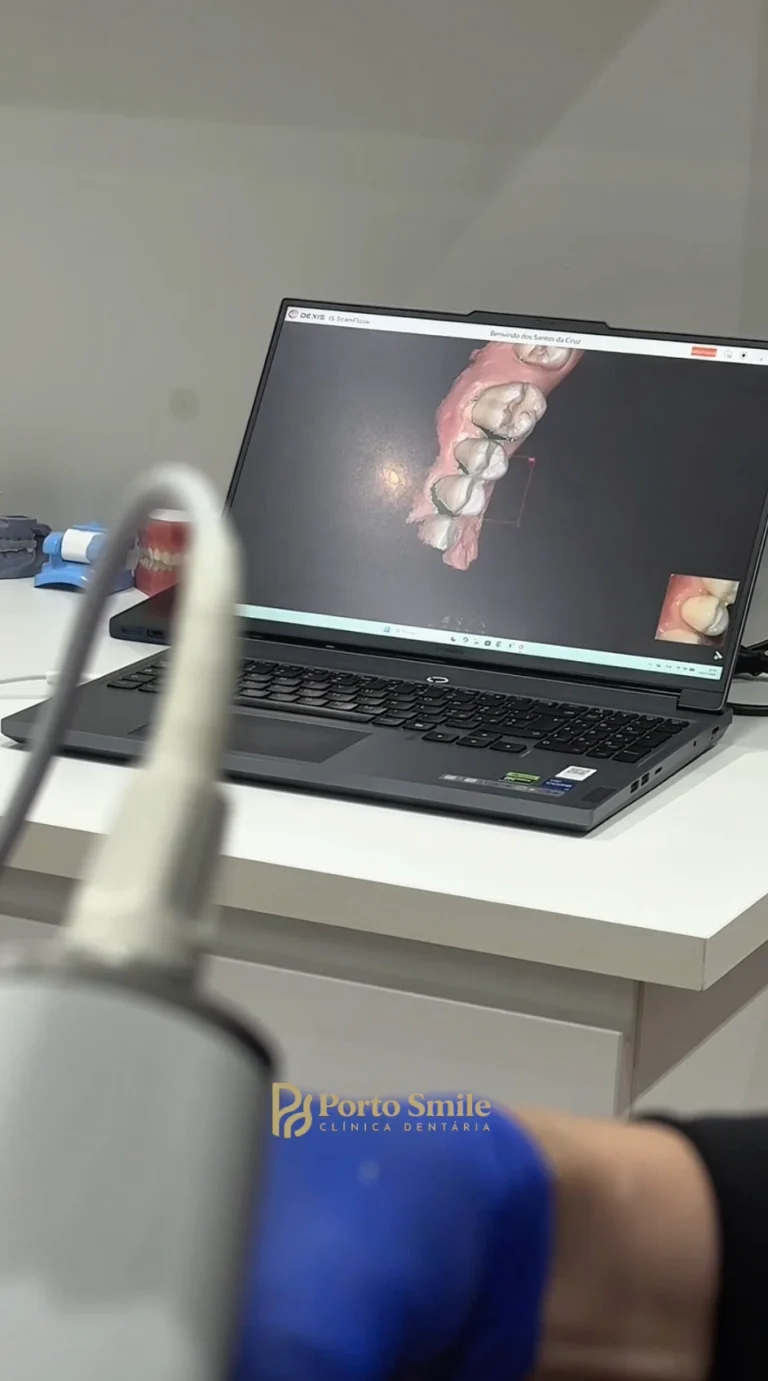 Análise digital do encaixe dentário em consulta na Porto Smile