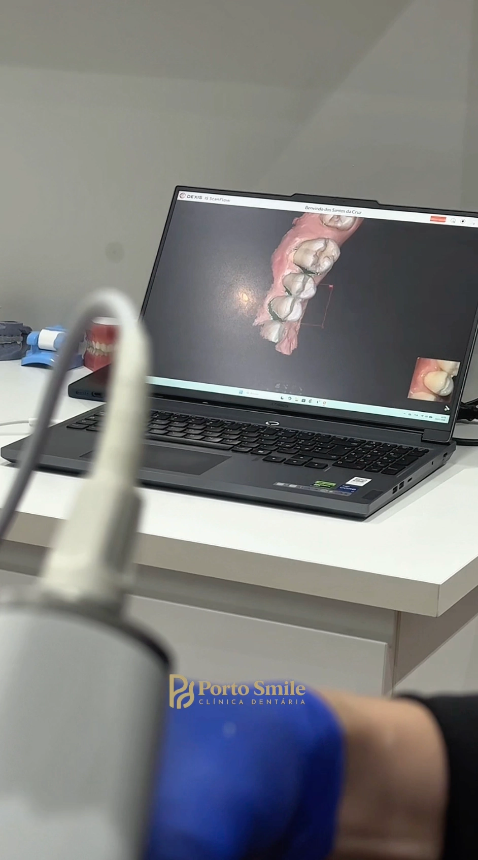 Análise digital do encaixe dentário em consulta na Porto Smile